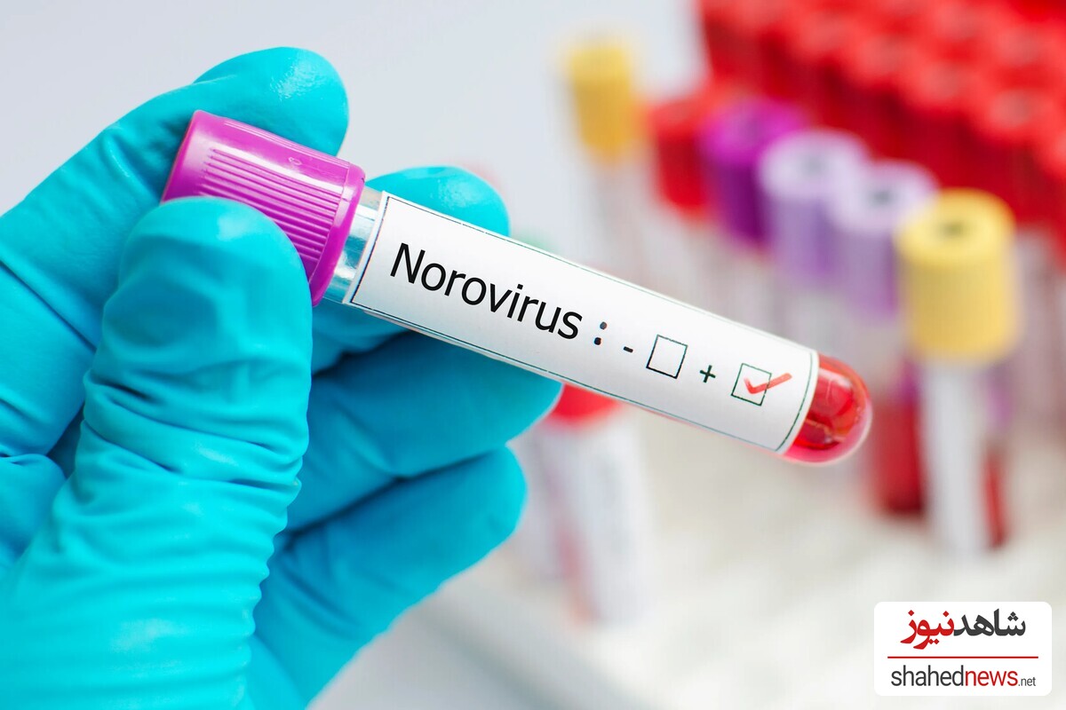 Norovirus