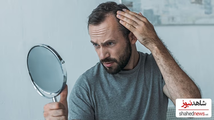 Hair loss