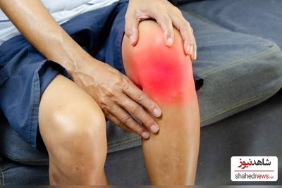 4 Effective Ways to Relieve Shooting Pain in Your Leg