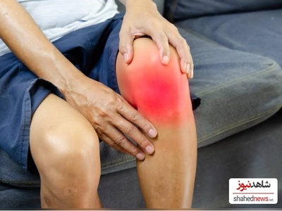 4 Effective Ways to Relieve Shooting Pain in Your Leg