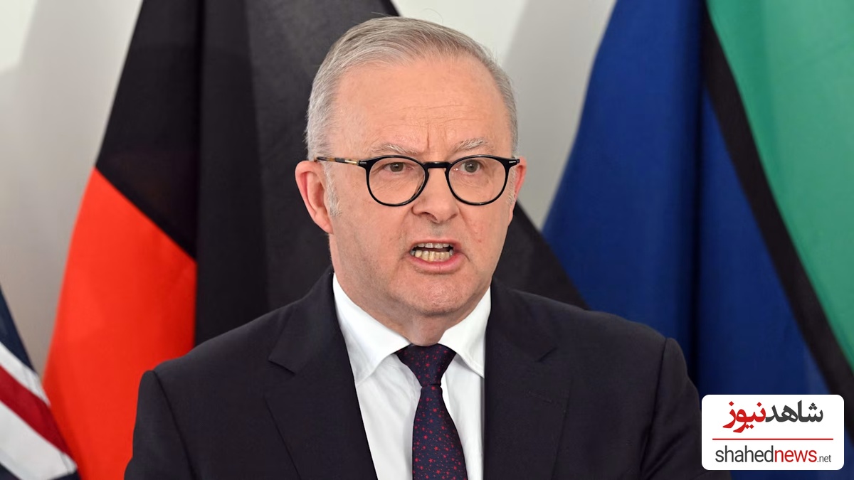 Anthony Albanese