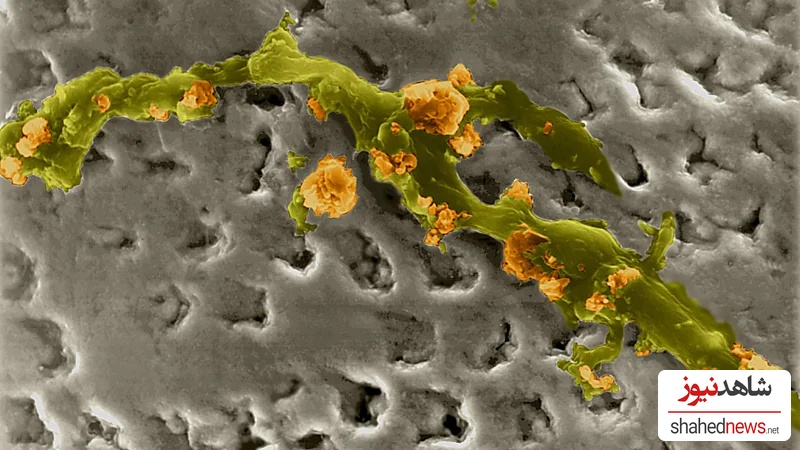 bacteria