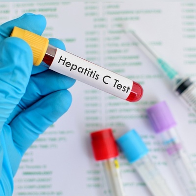 England on the Brink of Eliminating Hepatitis C in a Major Health Breakthrough