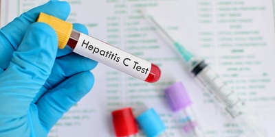 England on the Brink of Eliminating Hepatitis C in a Major Health Breakthrough