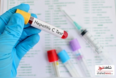 England on the Brink of Eliminating Hepatitis C in a Major Health Breakthrough