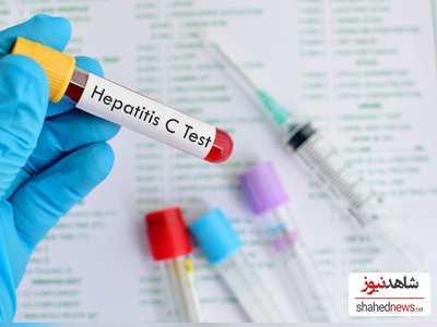 England on the Brink of Eliminating Hepatitis C in a Major Health Breakthrough
