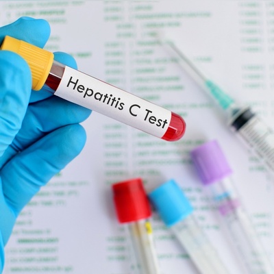 England on the Brink of Eliminating Hepatitis C in a Major Health Breakthrough