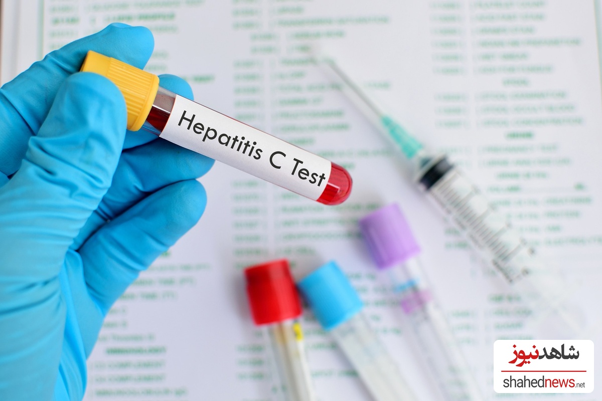 England on the Brink of Eliminating Hepatitis C in a Major Health Breakthrough
