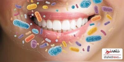 What to Eat for a Healthier Mouth? and Happier Good Bacteria