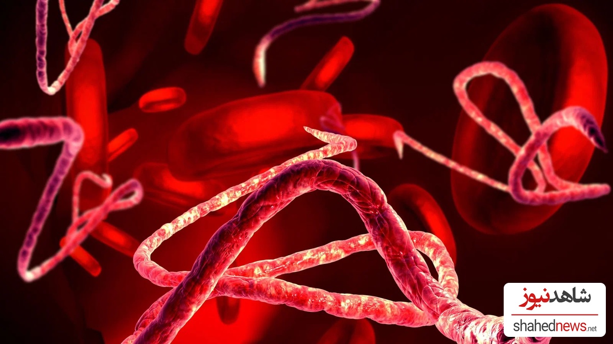 Ebola