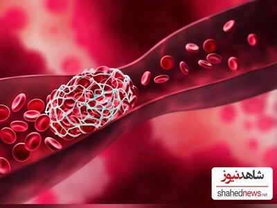 Reducing Blood Thickness with Traditional Remedies